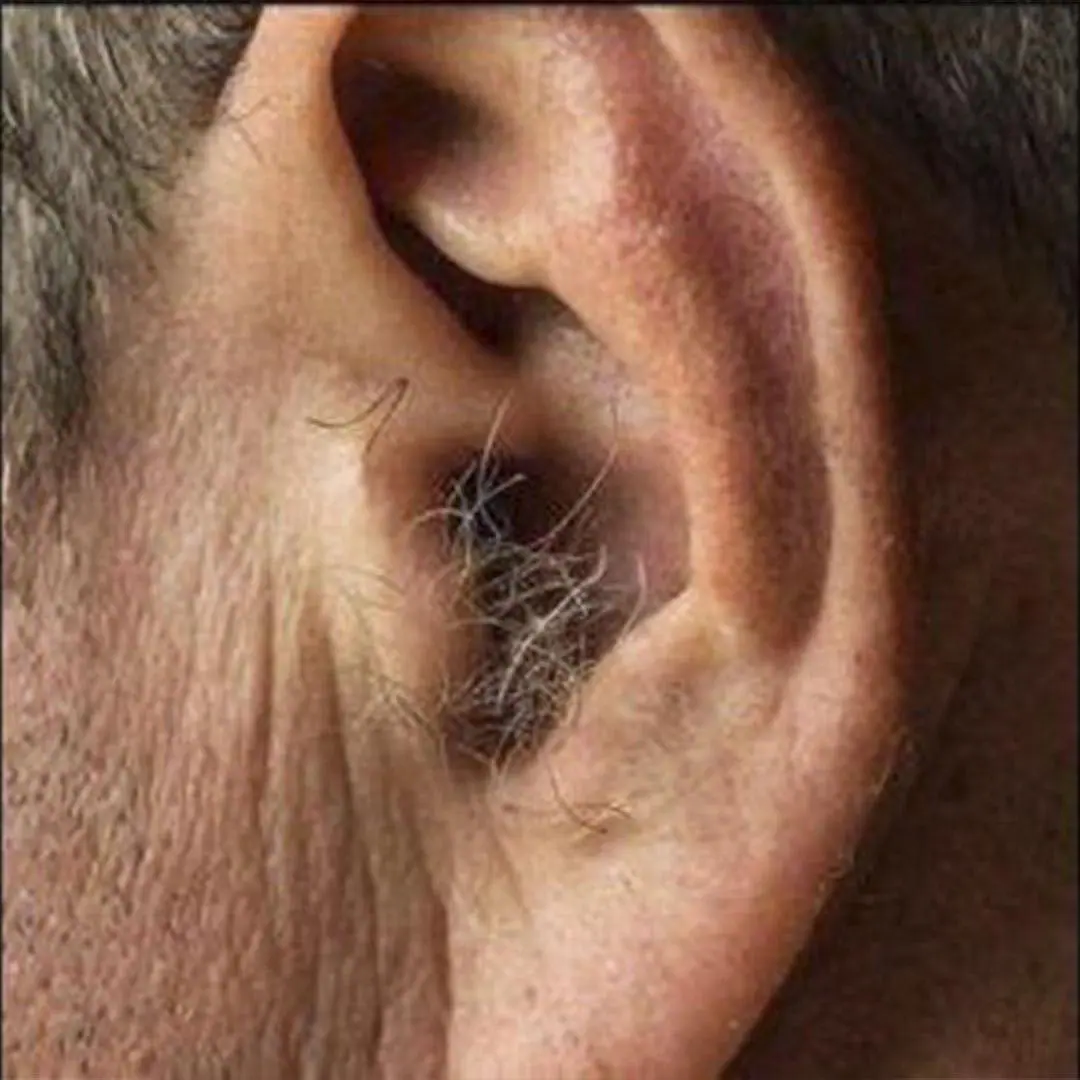 Le saviez vous si des poils commencent a pousser dans vos oreilles.jpg