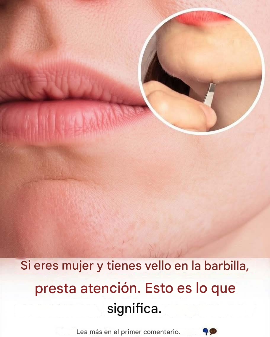 Translated image es