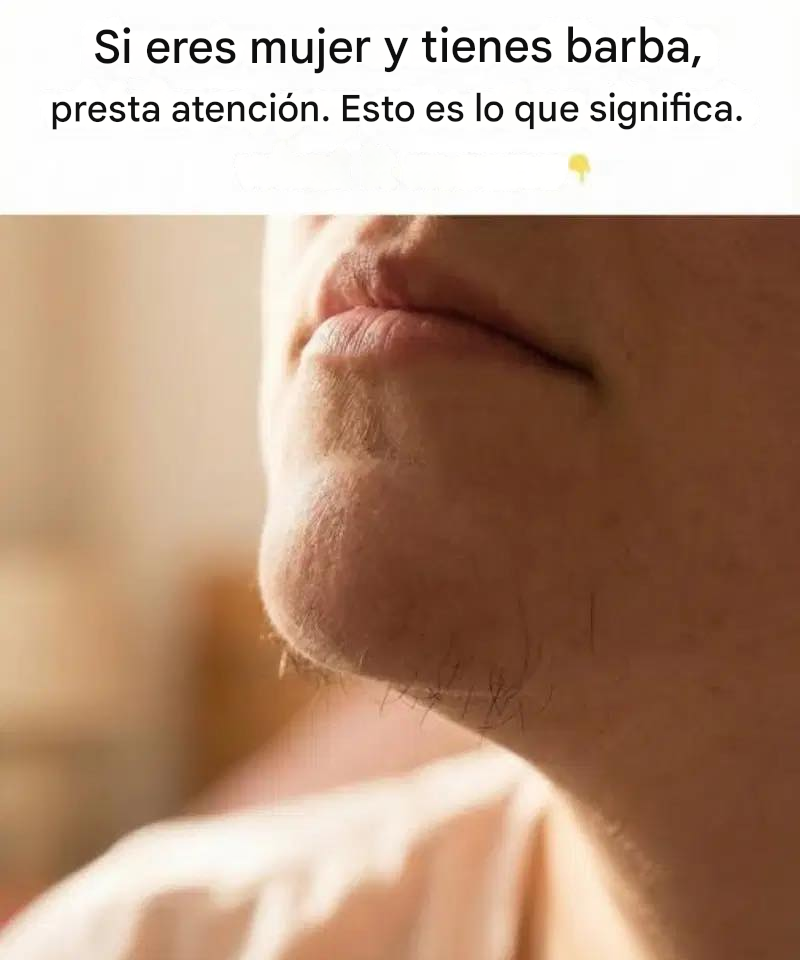 Translated image es