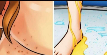 Translated image es