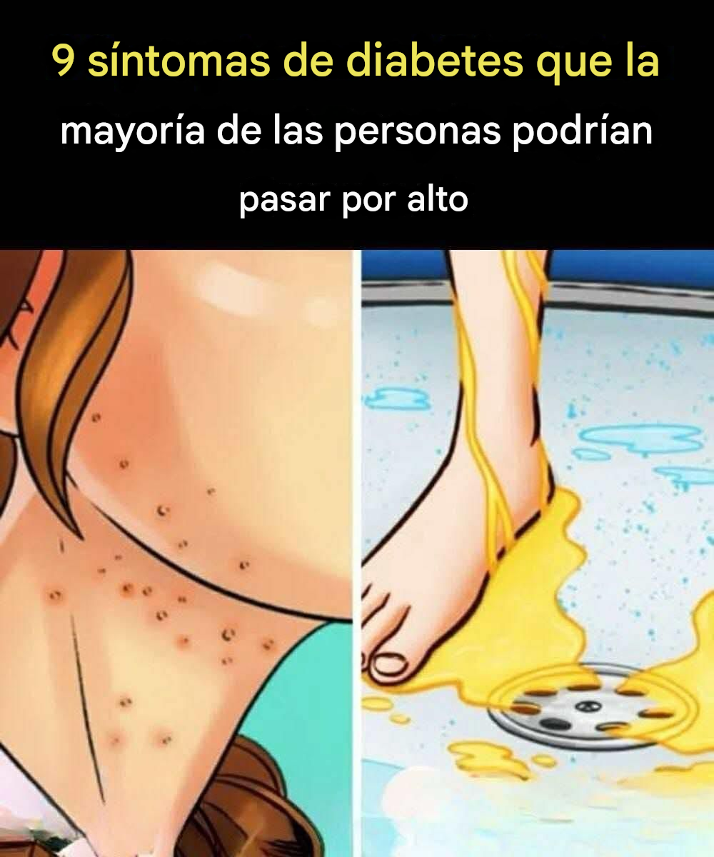 Translated image es