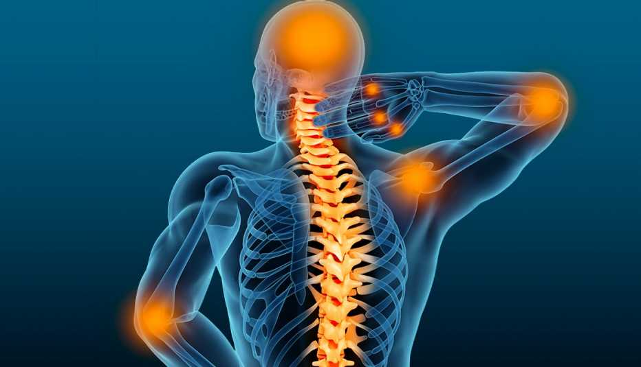 Dolor fibromialgia
