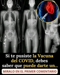 Alerta mundial para los vacunados contra COVID